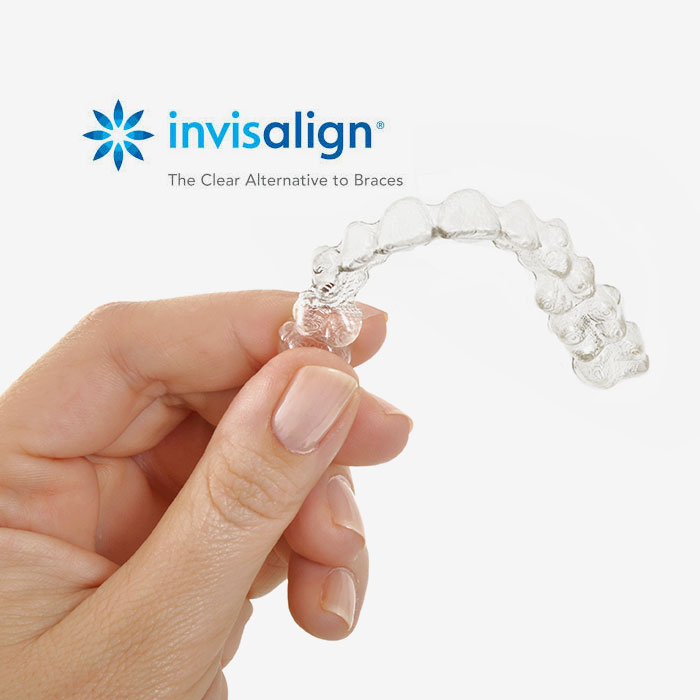 Invisalign Braces